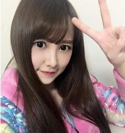 SNH48成員唐安琪遇意外嚴(yán)重?zé)齻? alt=