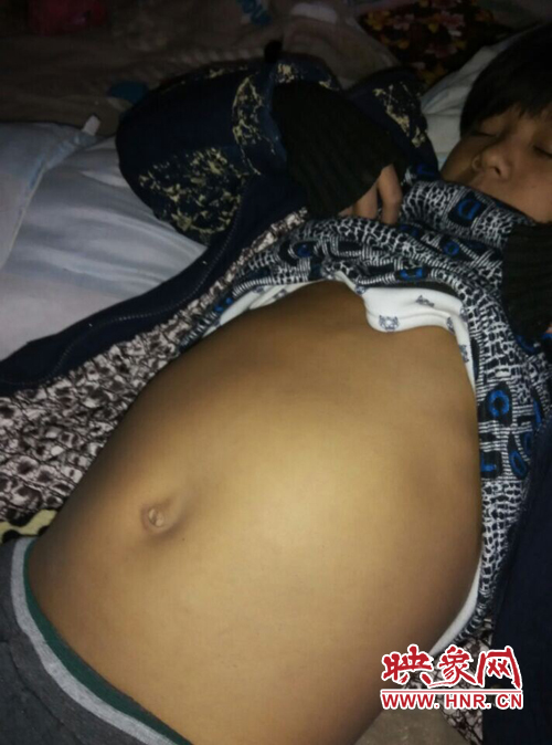 寧陵少年患病十幾年仍堅持上學 無錢治病盼救助 寧陵少年患病十幾年仍堅持上學 無錢治病盼救助