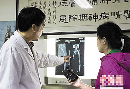 河北自鋸?fù)绒r(nóng)民已確定治療初步方案 河北自鋸?fù)绒r(nóng)民已確定治療初步方案