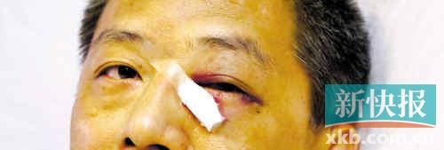 ■這起醫(yī)鬧事件，受傷的遠(yuǎn)遠(yuǎn)不只是熊旭明醫(yī)生的身體。