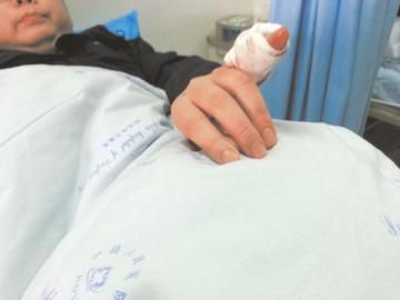 實(shí)習(xí)醫(yī)生陳洪左手的小拇指肌腱斷裂。