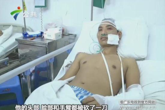 另一名傷者頭部、臉部和手臂都被砍了一刀。(視頻截圖)