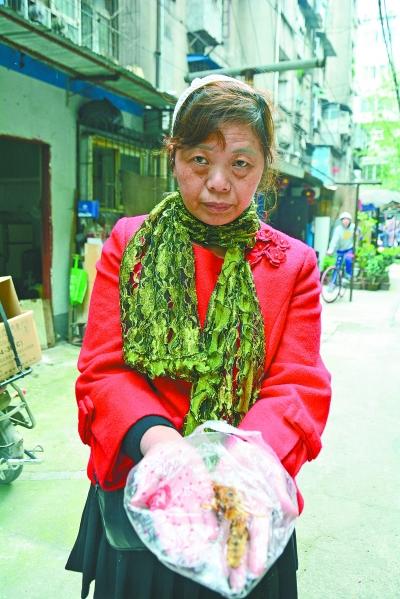 頭部受傷的黃女士展示兩根大魚刺。