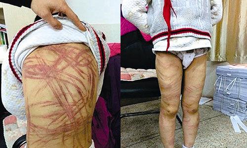 南京虐童案養(yǎng)母致歉:將用加倍關(guān)愛彌補過失 南京虐童案養(yǎng)母致歉:將用加倍關(guān)愛彌補過失