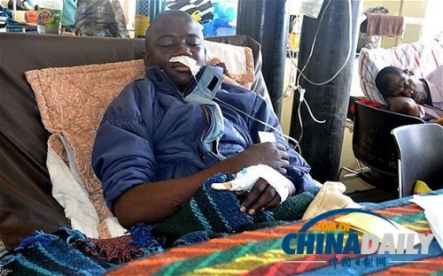 雖然已經(jīng)在醫(yī)院接受了近一個月的恢復(fù)治療，卡托卡的身體仍然非常虛弱。