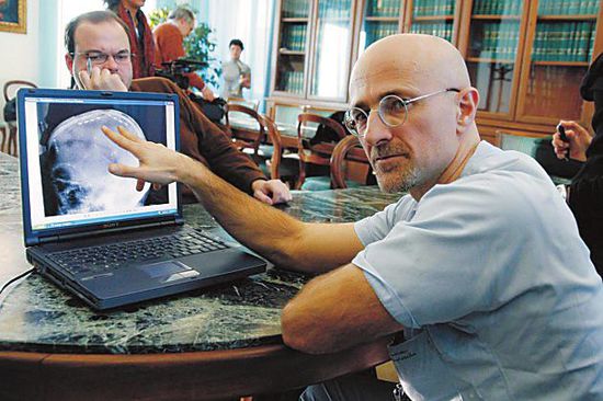 圖為卡納維洛醫(yī)生，不少人認為他的想法非常瘋狂