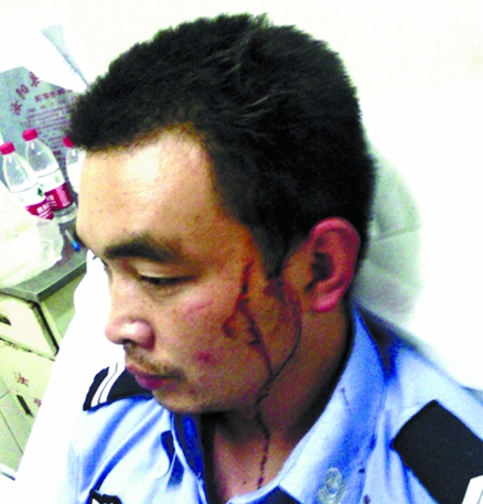 汝陽協(xié)警遭賭徒暴力抗法并圍毆 公安局稱這是內部的事 汝陽協(xié)警遭賭徒暴力抗法并圍毆 公安局稱這是內部的事