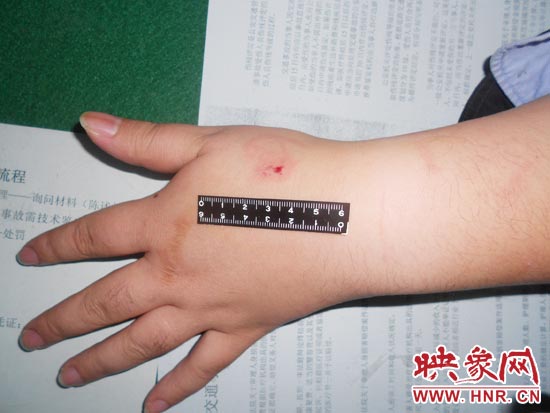 為幫助無證駕駛的朋友逃避處罰，新鄉(xiāng)的王某竟對執(zhí)勤民警大打出手，還將一名民警的手臂咬傷