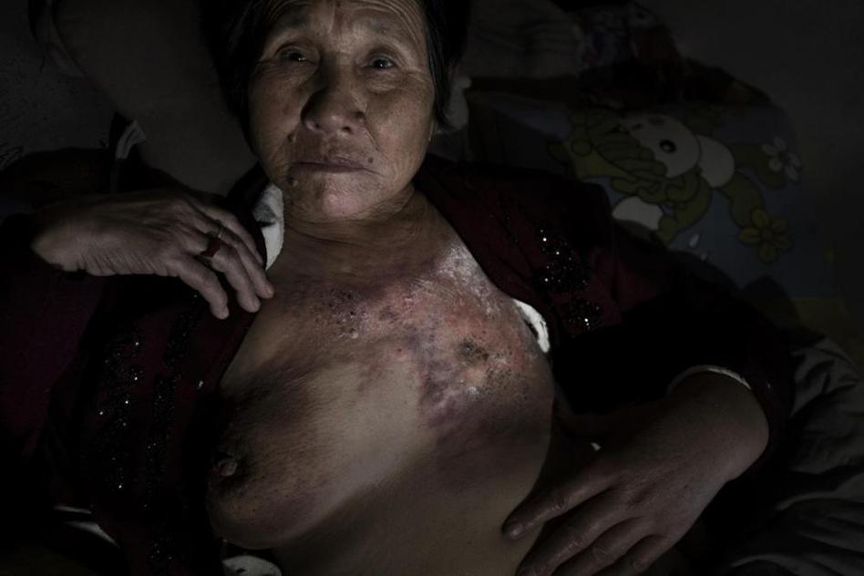 多地水污染嚴(yán)重 “癌癥村”人處境堪憂 多地水污染嚴(yán)重 “癌癥村”人處境堪憂