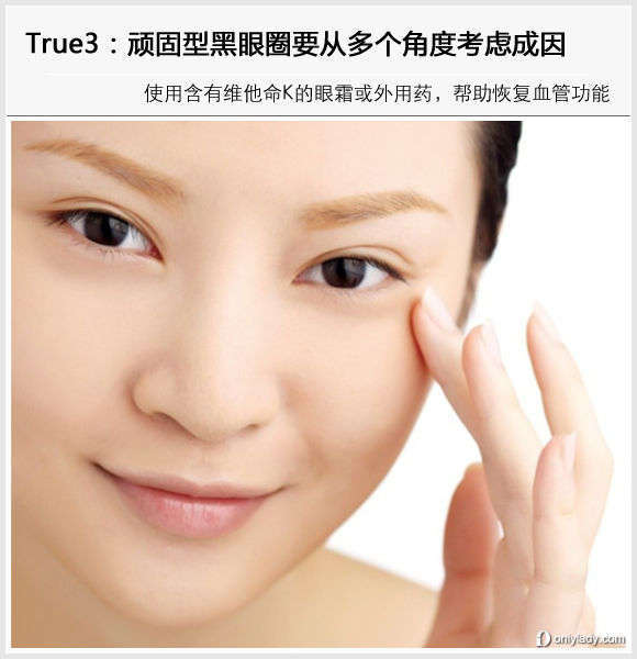 頑固型黑眼圈要從多個角度考慮成因 頑固型黑眼圈要從多個角度考慮成因