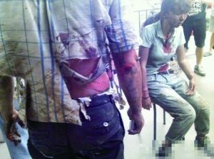 廈門公交起火爆炸已造成48人死亡 約30人受傷 廈門公交起火爆炸已造成48人死亡 約30人受傷