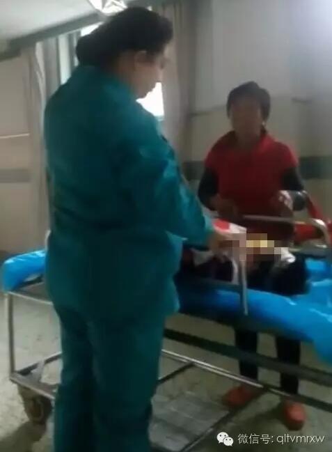 涵涵爸爸告訴《每日新聞》記者：“沒想到是熱水，大人也沒看，一時(shí)疏忽，掉進(jìn)去了。抱出來的時(shí)候這個(gè)皮已經(jīng)掉了。”