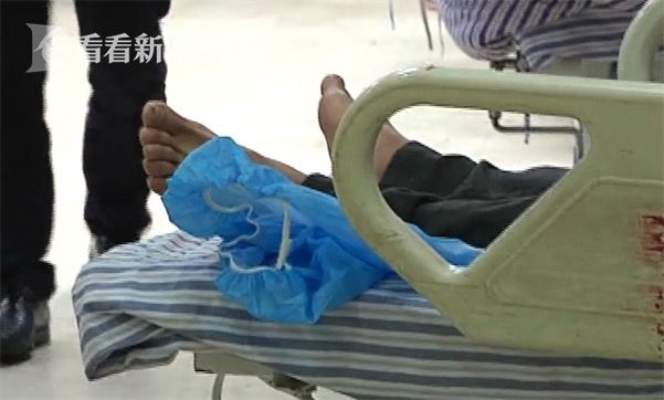 黃鱔從肛門鉆進肚子 男子被送醫(yī)不愿多談事情經過