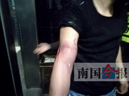 覃先生手臂被卡的部位受傷流血，所幸傷勢(shì)無大礙。 通訊員 王建民 攝