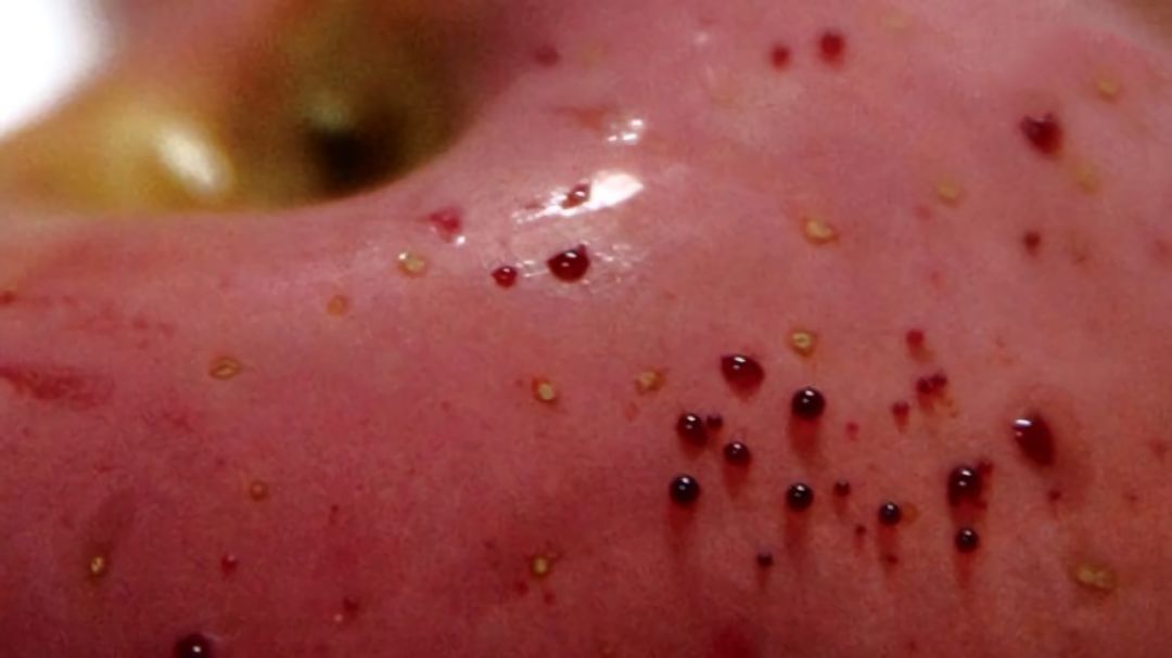 嚇懵！女子用熱水泡蘋果結(jié)果冒出血珠 咋回事？