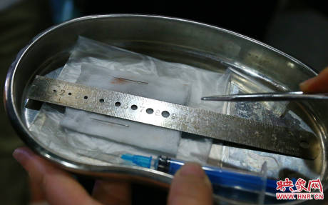 駐馬店失明雙胞胎手術(shù)成功 駐馬店失明雙胞胎手術(shù)成功