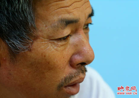 駐馬店失明雙胞胎手術(shù)成功 駐馬店失明雙胞胎手術(shù)成功