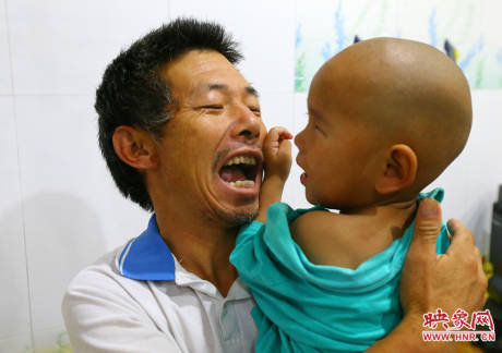 駐馬店失明雙胞胎手術(shù)成功 駐馬店失明雙胞胎手術(shù)成功