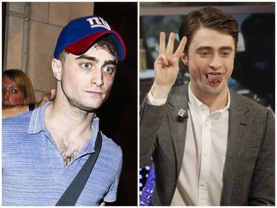 丹尼爾日前被拍到骨瘦如柴，不似2月份健康