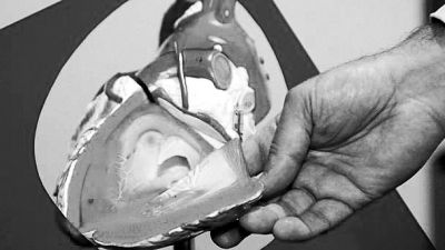 威廉斯領(lǐng)導(dǎo)的研究團隊已經(jīng)利用人體脂肪干細胞，成功3D打印出心臟血管和心臟瓣膜，待一顆心臟的所有部件打