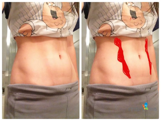 蔡依林 你的馬甲線“脫妝”了！