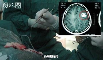 微博截屏 微博截屏