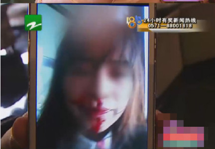 24歲女大學(xué)生被包養(yǎng) 意外懷孕遭對方帶人圍毆 24歲女大學(xué)生被包養(yǎng) 意外懷孕遭對方帶人圍毆