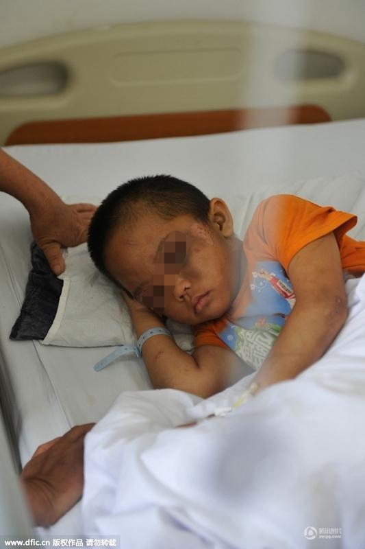 圖為全身傷痕累累的小進(jìn)。