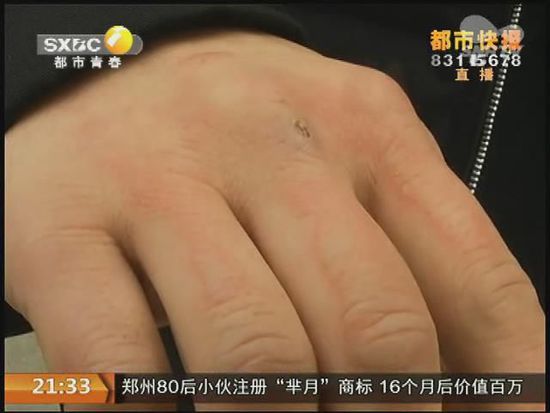 說到這足療拔罐，估計大伙都不陌生，但是想起4號晚上的拔罐的經(jīng)歷，呂先生現(xiàn)在想起來，還心有余悸。