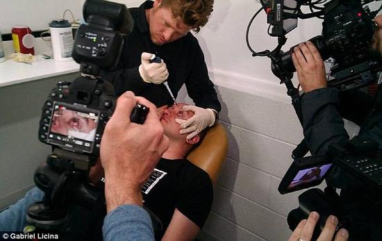 該實(shí)驗(yàn)是由加州一支名為“生物駭客”的實(shí)驗(yàn)團(tuán)隊(duì)開展的。他們使用了一種名為二氫卟吩e6（Ce6）的物質(zhì)的溶液。Ce6常見于深海魚體內(nèi)，有光敏特性，通常用于癌癥治療研究中。研究團(tuán)隊(duì)將Ce6與胰島素和鹽水混合起來，得到一種溶液，可以在低光照條件下提高人類的視力。