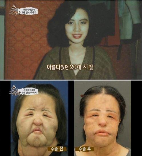 美女整容變“電風(fēng)扇大媽” 盤點整容失敗驚悚案例 美女整容變“電風(fēng)扇大媽” 盤點整容失敗驚悚案例