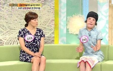 美女整容變“電風(fēng)扇大媽” 盤點整容失敗驚悚案例 美女整容變“電風(fēng)扇大媽” 盤點整容失敗驚悚案例